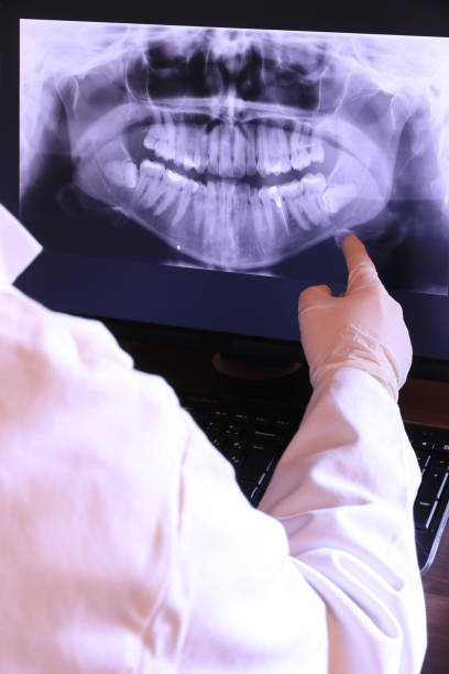 Best After-Hours Emergency Dentist in Gordon, PA