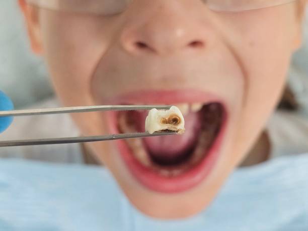Best Emergency Dental Surgery in Gordon, PA
